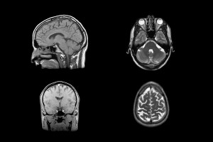 mindfulness y el cerebro